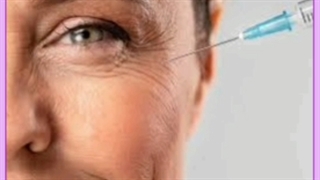 علت سردرد بعد از بوتاکس چیست؟