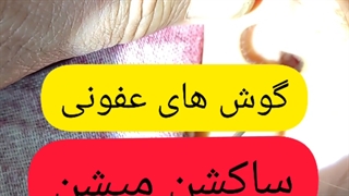 عفونت گوش