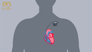 باطری قلب | دکتر یاسمین افسری