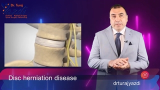 Disc herniation disease