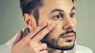 رفع سیاهی و گودی زیر چشم