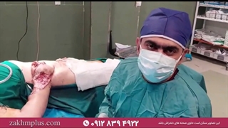 جراحی پیوند عروق و جراحی ارتوپدی بیمار میانسال